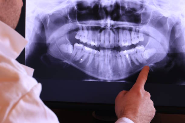 Best Emergency Care for Gum Disease in North Aurora, IL