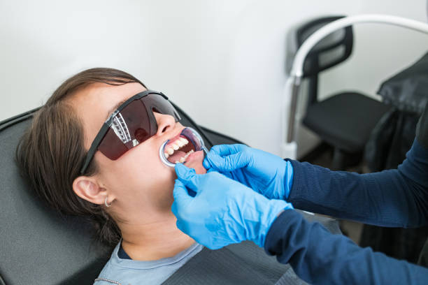 Best Knocked-Out Tooth (Avulsed Tooth) Treatment in North Aurora, IL